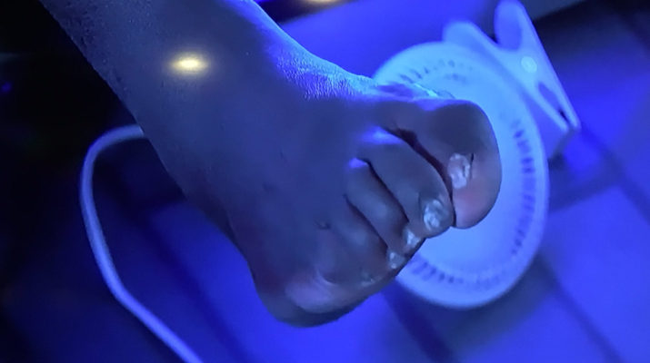 Shaq's toes